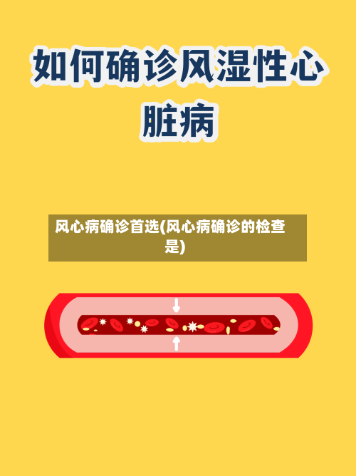 风心病确诊首选(风心病确诊的检查是)-第2张图片