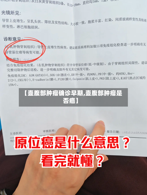 【壶腹部肿瘤确诊早期,壶腹部肿瘤是否癌】