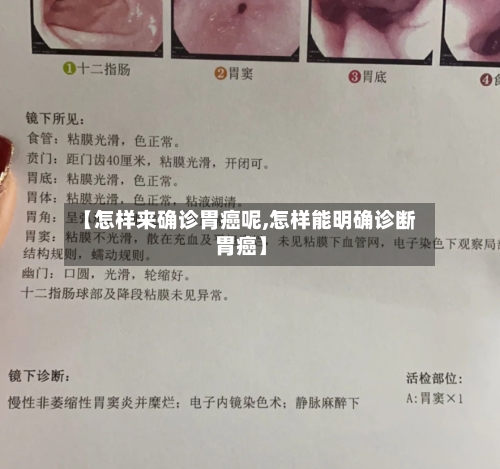 【怎样来确诊胃癌呢,怎样能明确诊断胃癌】-第3张图片