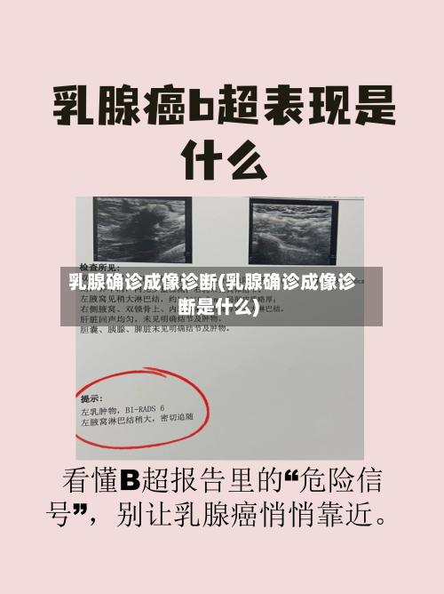 乳腺确诊成像诊断(乳腺确诊成像诊断是什么)-第2张图片