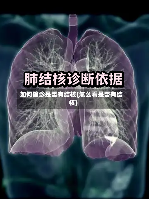 如何确诊是否有结核(怎么看是否有结核)