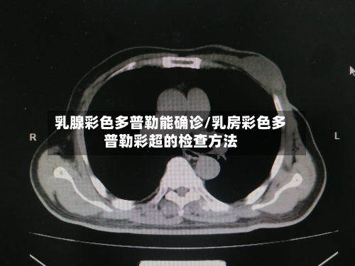 乳腺彩色多普勒能确诊/乳房彩色多普勒彩超的检查方法
