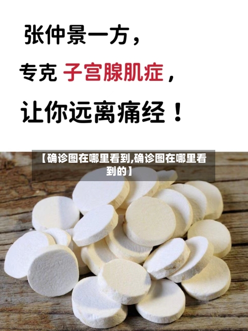 【确诊图在哪里看到,确诊图在哪里看到的】