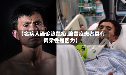 【名病人确诊腺鼠疫,腺鼠疫患者具有传染性是因为】-第2张图片