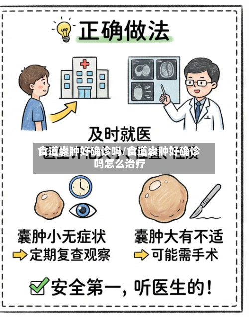 食道囊肿好确诊吗/食道囊肿好确诊吗怎么治疗