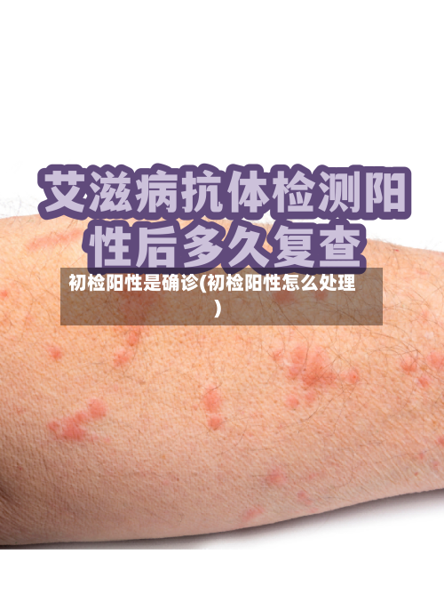初检阳性是确诊(初检阳性怎么处理)-第2张图片