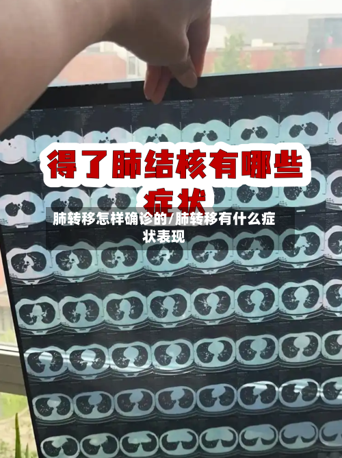 肺转移怎样确诊的/肺转移有什么症状表现