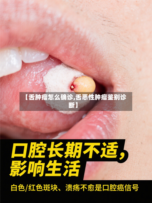 【舌肿瘤怎么确诊,舌恶性肿瘤鉴别诊断】-第3张图片