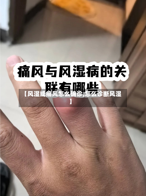 【风湿或痛风怎么确诊,怎么诊断风湿】