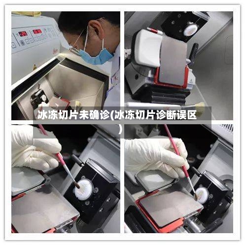 冰冻切片未确诊(冰冻切片诊断误区)