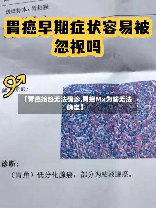 【胃癌始终无法确诊,胃癌Mx为啥无法确定】