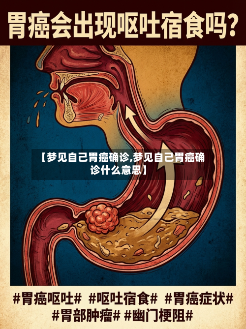 【梦见自己胃癌确诊,梦见自己胃癌确诊什么意思】-第2张图片