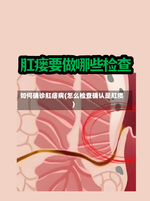 如何确诊肛痿病(怎么检查确认是肛瘘)-第2张图片